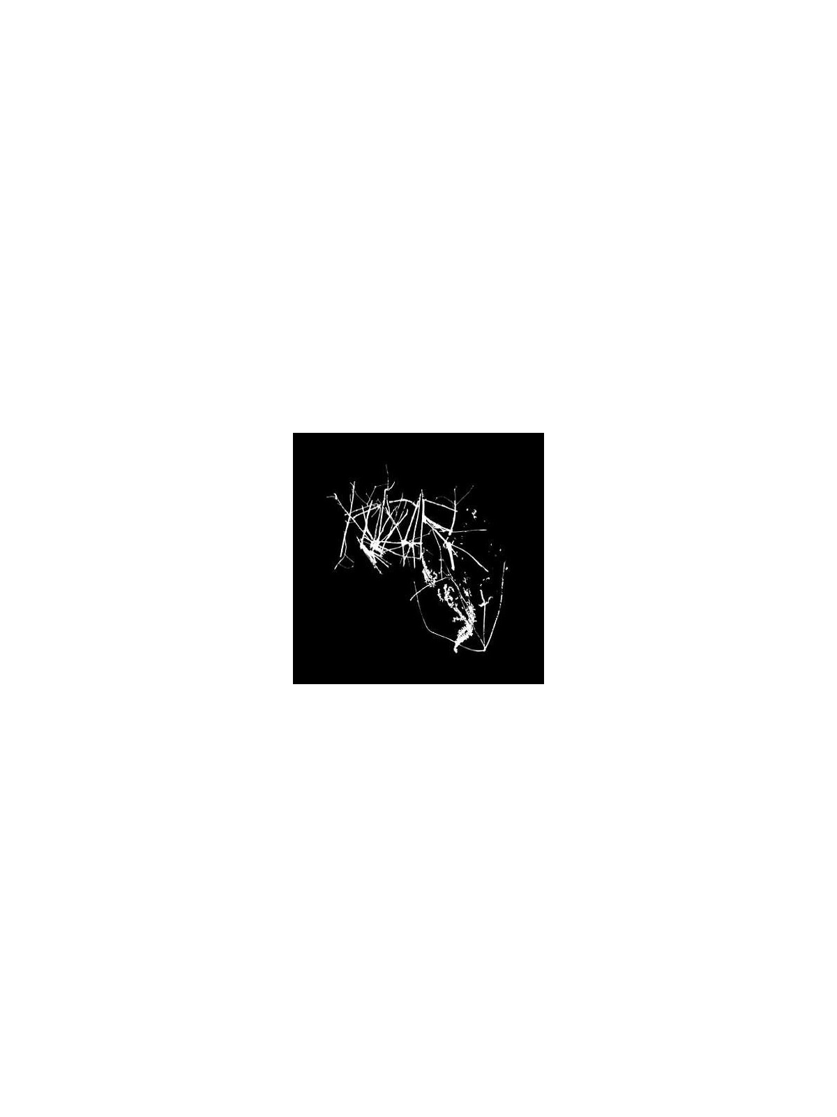 Klor (CD)